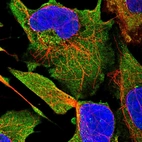 Immunofluorescent staining of human cell line U-2 OS shows localization to cytosol & vesicles.