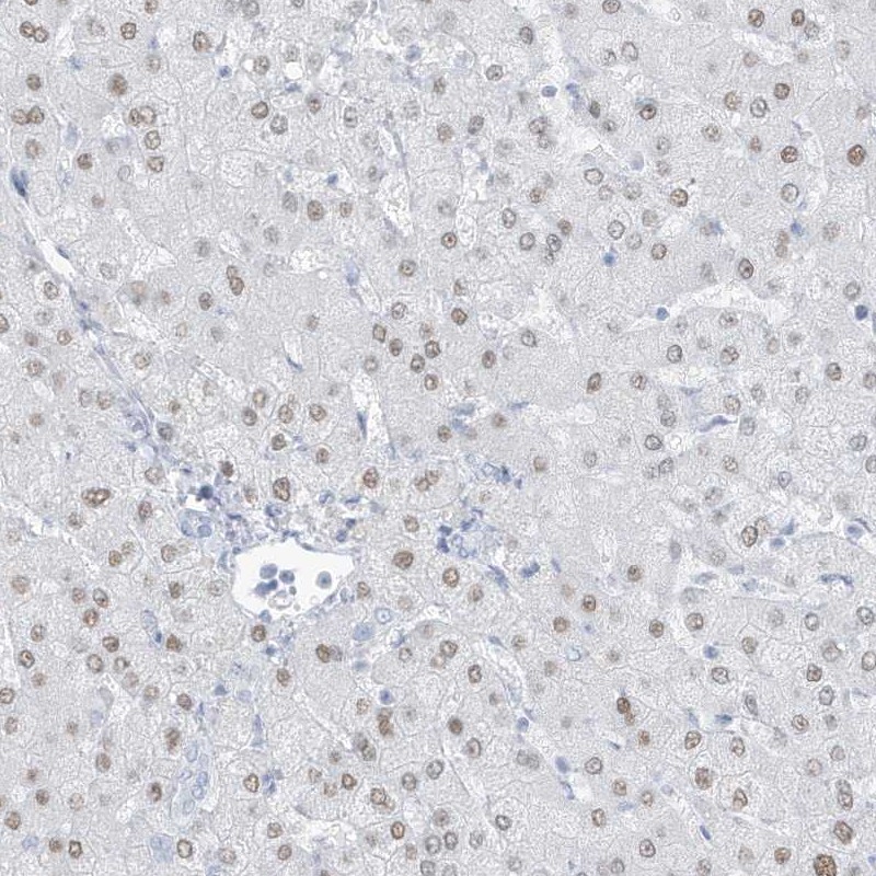 Anti-ZFP64 Antibody