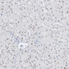 Anti-ZFP64 Antibody