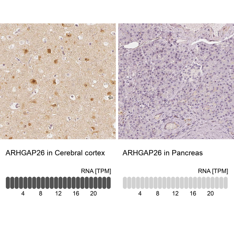 Anti-ARHGAP26 Antibody