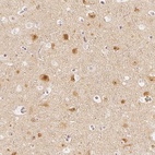 Immunohistochemical staining of human cerebral cortex shows high expression.