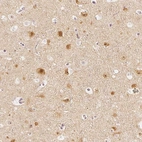 Immunohistochemical staining of human cerebral cortex shows high expression.