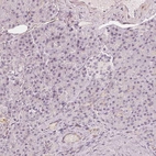 Immunohistochemical staining of human pancreas shows low expression as expected.
