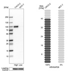 Western blot analysis in human cell lines Caco-2 and MCF-7 using Anti-ARHGAP26 antibody. Corresponding ARHGAP26 RNA-seq data are presented for the same cell lines. Loading control: Anti-GAPDH.