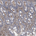 Anti-SLC9A2 Antibody