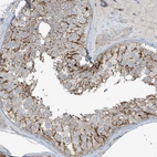 Immunohistochemical staining of human testis shows strong membranous positivity in cells in seminiferous ducts.