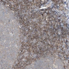 Immunohistochemical staining of human tonsil shows strong membranous positivity in non-germinal center cells.