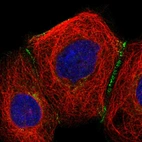 Immunofluorescent staining of human cell line A-431 shows localization to cell junctions.