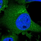 Immunofluorescent staining of human cell line U-251 MG shows localization to cytosol, centrosome & vesicles.