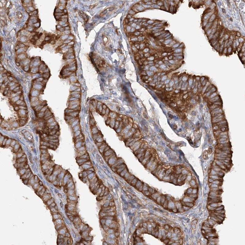 Anti-TBC1D5 Antibody