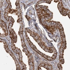 Anti-TBC1D5 Antibody