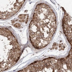 Immunohistochemical staining of human testis shows moderate to strong cytoplasmic positivity in cells in seminiferous ducts and Leydig cells.