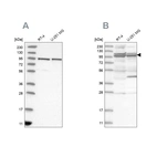 Western blot analysis using Anti-TBC1D5 antibody HPA035125 (A) shows similar pattern to independent antibody HPA035126 (B).