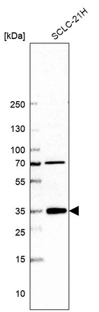 Western blot analysis in human cell line SCLC-21H.