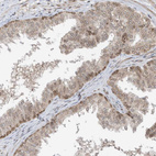Immunohistochemical staining of human prostate shows weak to moderate positivity in nuclear membrane in glandular cells.