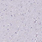 Immunohistochemical staining of human cerebral cortex shows moderate dot-like positivity.