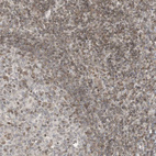 Immunohistochemical staining of human tonsil shows weak positivity in nuclear membrane in non-germinal center cells.