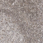 Immunohistochemical staining of human tonsil shows weak positivity in nuclear membrane in non-germinal center cells.