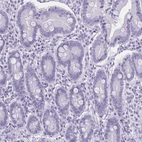 Immunohistochemical staining of human duodenum shows no positivity in glandular cells as expected.