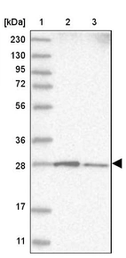 Lane 1: Marker [kDa] 230, 130, 95, 72, 56, 36, 28, 17, 11_br/_Lane 2: Human cell line RT-4_br/_Lane 3: Human cell line U-251MG sp