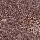 Anti-PRKDC Antibody