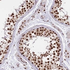 Immunohistochemical staining of human testis shows strong nuclear positivity in cells in seminiferous ducts.