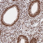 Immunohistochemical staining of human endometrium shows strong nuclear positivity in glandular and stromal cells.