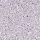 Immunohistochemical staining of human liver shows no positivity in hepatocytes as expected.