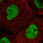 Immunofluorescent staining of human cell line A-431 shows localization to nucleoplasm.
