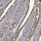 Anti-ZNF641 Antibody