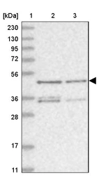 Lane 1: Marker [kDa] 230, 130, 95, 72, 56, 36, 28, 17, 11_br/_Lane 2: Human cell line RT-4_br/_Lane 3: Human cell line U-251MG sp
