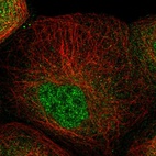 Immunofluorescent staining of human cell line A-431 shows localization to nucleoplasm.