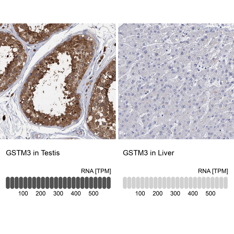 Anti-GSTM3 Antibody