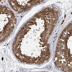 Immunohistochemical staining of human testis shows strong cytoplasmic positivity in cells in seminiferous ducts.