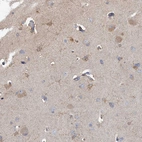 Immunohistochemical staining of human cerebral cortex shows weak cytoplasmic positivity in neurons.