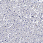 Immunohistochemical staining of human liver shows no positivity in hepatocytes as expected.