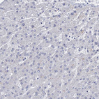 Anti-GSTM3 Antibody