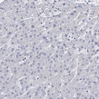 Immunohistochemical staining of human liver shows no positivity in hepatocytes as expected.