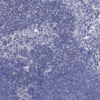 Anti-GSTM3 Antibody