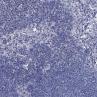 Immunohistochemical staining of human lymph node shows no positivity in non-germinal center cells as expected.