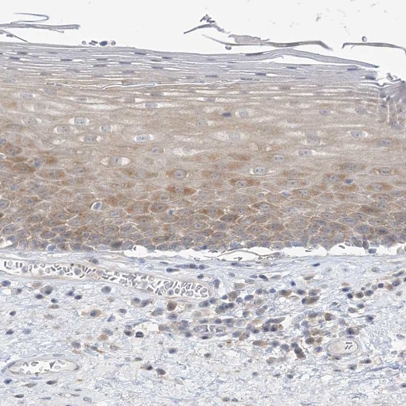 Anti-THADA Antibody
