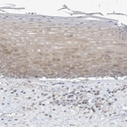 Anti-THADA Antibody