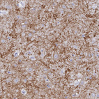 Anti-GRIA1 Antibody