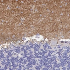 Immunohistochemical staining of human cerebellum shows strong positivity in neuronal processes in neuropil.