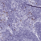 Immunohistochemical staining of human lymph node shows strong cytoplasmic positivity in a subset of non-germinal center cells.