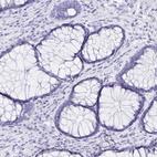 Anti-GRIA1 Antibody