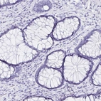 Immunohistochemical staining of human rectum shows no positivity in glandular cells as expected.