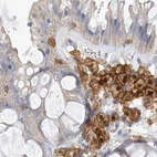 Immunohistochemical staining of human colon using Anti-NAGK antibody HPA035206.