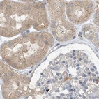 Immunohistochemical staining of human kidney using Anti-NAGK antibody HPA035206.