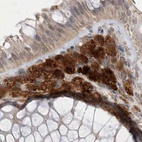 Immunohistochemical staining of human colon using Anti-NAGK antibody HPA035207.